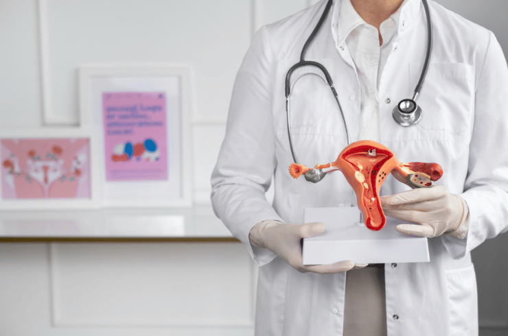 PCOS Management